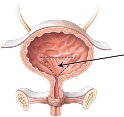 What is the structure or area that the arrow is pointing to?   A)  peritoneum B)  internal urethral sphincter C)  detrusor muscle D)  trigone