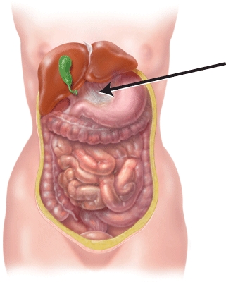 Identify the structure indicated in the figure.   A)  gallbladder B)  sigmoid colon C)  greater omentum D)  lesser omentum