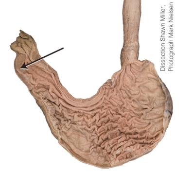 What is the structure the arrow is pointing to?   A)  rugae B)  fundus C)  cardia D)  pyloric sphincter