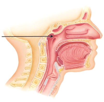 <strong>What is the name of the area indicated? </strong> A) nasopharynx B) sphenoidal sinus C) oropharynx D) frontal sinus