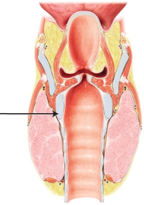 In this lateral view of the larynx, which cartilage is indicated?   A)  epiglottis B)  cricoid C)  thyroid D)  cuneiform