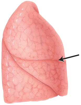 <strong>In this lateral view of the right lung, the arrow is pointing to which structure? </strong> A) hilum B) cardiac notch C) apex D) horizontal fissure