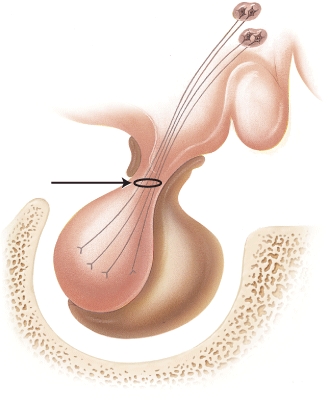The arrow is pointing to which structure?   A)  paraventricular nucleus B)  supraoptic nucleus C)  infundibular venous plexus D)  axons of neurosecretory cells