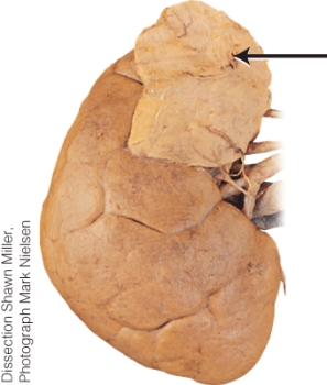 What is the endocrine gland labeled with the arrow?   A)  adrenal B)  pineal C)  thymus D)  testis