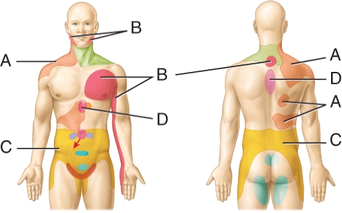 Referred pain site for the kidneys   A)  A B)  B C)  C D)  D