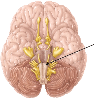 The structure indicated by the arrow   A)  is where the rubrospinal tract begins. B)  is where the corticospinal tract decussates. C)  is where the spinothalamic tract crosses. D)  is where third-order neurons of the posterior (dorsal)  column tract originate.