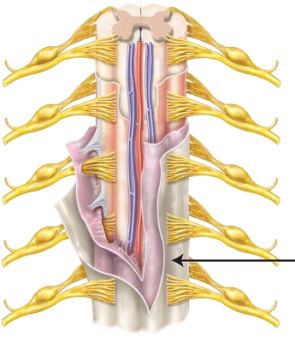 The meninx indicated by the line is the _____.   A)  pia mater B)  arachnoid mater C)  dura mater