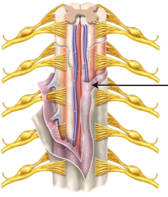 The meninx indicated by the line is the _____.   A)  pia mater B)  arachnoid mater C)  dura mater