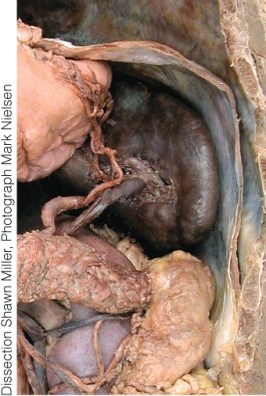 The parenchyma (functional portion) of this organ is comprised of _____ (lymphatic tissue) and _____ (blood-filled sinuses).  