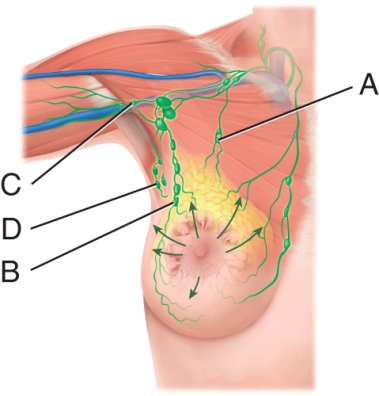 More than 75% of the lymph drainage of the breast is to the _____. In breast cancer, it is possible that cancer cells leave the breast and lodge in these nodes. From here, metastasis may develop in other axillary nodes. a) A b) B c) C d) D