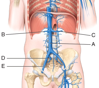 The left testicular (or ovarian)  vein drains into the _____, whereas the right testicular (or ovarian)  vein drains into the _____.   A)  A; B B)  B; C C)  D; E D)  C; A