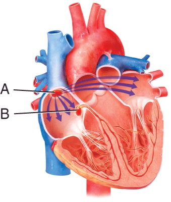 Match the component of the conduction system of the heart with the description. Atrioventricular (AV)  bundle (bundle of His) :   A)  carry depolarization wave toward apex of heart B)  the electrical connection between the atria and the ventricles