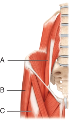 The muscle indicated by line A is the   A)  Psoas major B)  Gracilis C)  Obturator externus D)  Iliacus