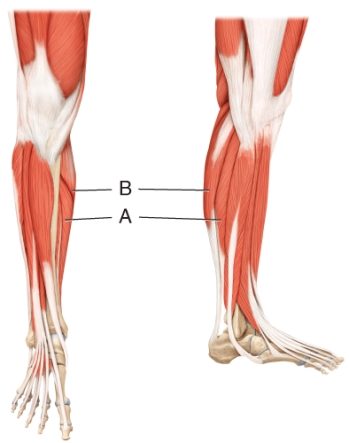 What muscle is indicated by line A?  