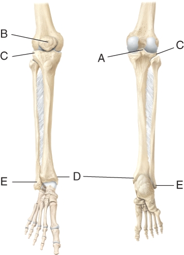 <strong>Identify the medial malleolus. </strong> A) A B) B C) C D) D E) E