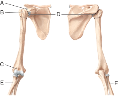 <strong>Identify the head of the radius. </strong> A) A B) B C) C D) D E) E