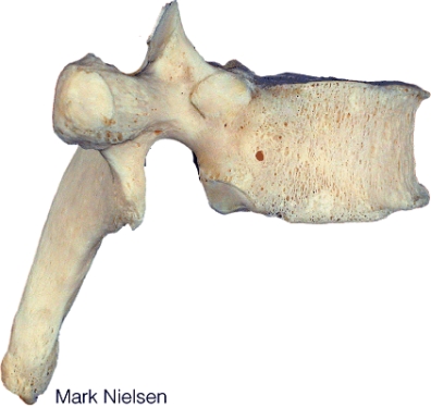 What type of vertebra is shown in here?   A)  cervical B)  thoracic C)  lumbar D)  sacral