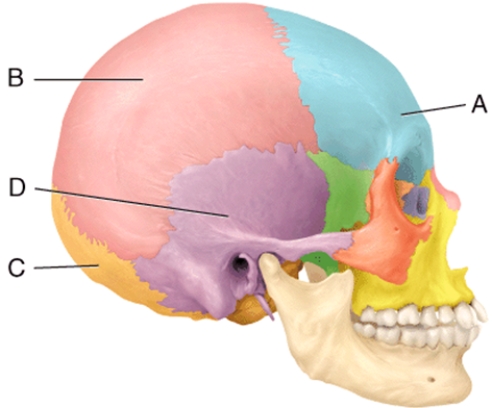 Which two cranial bones unite to form the lambdoid suture?   A)  A and B B)  B and C C)  D and E D)  B and D E)  A and D