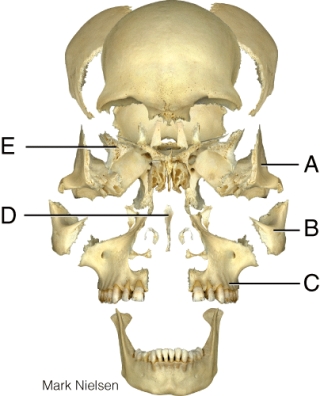 Where is the zygomatic bone?   A)  A B)  B C)  C D)  D E)  E