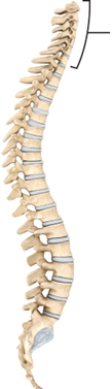 <strong>What region are these vertebrae from? </strong> A) cervical B) thoracic C) lumbar D) sacral E) coccygeal