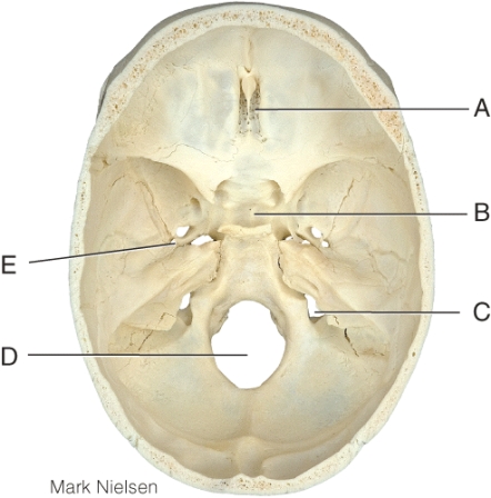 Where is the pituitary gland located?   A)  A B)  B C)  C D)  D E)  E