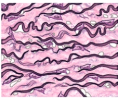 The major fiber type in this tissue is _____.  