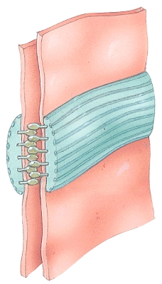 Name the type of cellular junction.  