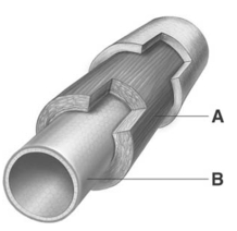   -If the figure shown is an elastic artery,the layer letter B is pointing to is composed of A) smooth muscle only. B) smooth muscle and elastic tissue. C) endothelium only. D) endothelium and basement membrane. E) elastic tissue only.