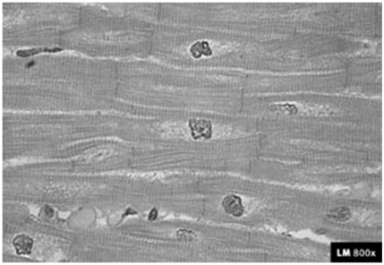   -  The type of muscle shown in the diagram is A) cardiac B) smooth C) skeletal