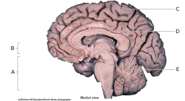   -This is a midsagittal section of the right half of the brain. What does  E  represent? A)  Cerebrum B)  Cerebellum C)  Corpus callosum D)  Diencephalon E)  Brainstem