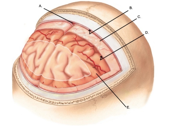   -What does  C  represent on the diagram of the skull and brain? A)  Subarachnoid space B)  Dural venous sinus C)  Pia mater D)  Arachnoid mater E)  Subdural space