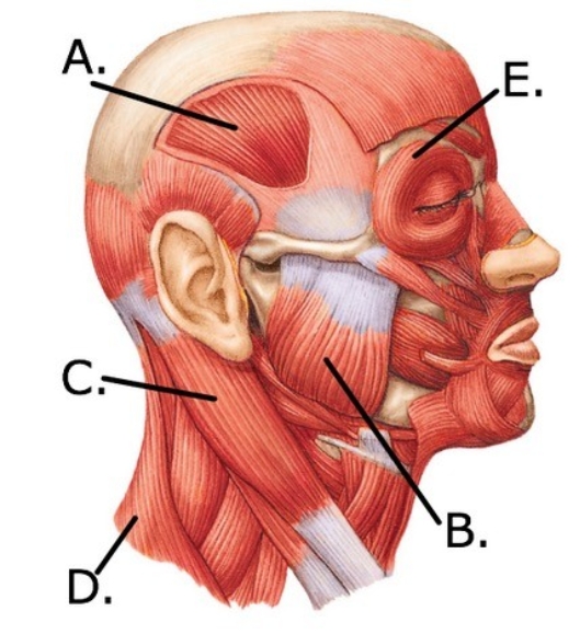   -The figure illustrates a lateral view muscles of the head and neck. Which muscle is indicated by  E ? A)  Orbicularis oculi B)  Temporalis C)  Trapezius D)  Sternocleidomastoid E)  Masseter