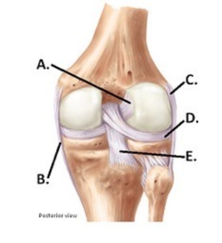   -The figure illustrates a posterior view of the right knee joint. What does  B  represent? A)  Medial (tibial)  collateral ligament (MCL)  B)  Posterior cruciate ligament (PCL)  C)  Anterior cruciate ligament (ACL)  D)  Lateral (fibular)  collateral ligament (LCL)  E)  Lateral meniscus