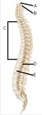   -What does structure  A  represent? A)  Atlas B)  Axis C)  Body of vertebra D)  Intervertebral disk E)  Thoracic region or curve