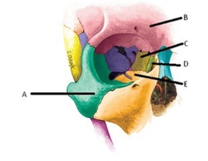   -The figure shows the bones of the right orbit. What bone does  D  represent? A)  Frontal B)  Maxilla C)  Zygomatic D)  Lacrimal E)  Ethmoid