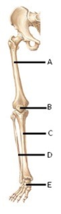   -The figure illustrates bones of the right lower limb. What does  D  represent? A)  Femur B)  Fibula C)  Tarsals D)  Tibia E)  Patella