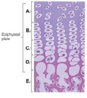   -This figure illustrates bone growth in length at the epiphyseal plate. Zone  B  represents A)  bone tissue of the diaphysis. B)  zone of calcification. C)  zone of hypertrophy. D)  zone of proliferation. E)  zone of resting cartilage.