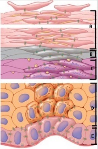   -The figure illustrates the layers of the epidermis. Which layer of the epidermis is  A ? A)  Stratum spinosum B)  Stratum corneum C)  Stratum basale D)  Stratum lucidum E)  Stratum granulosum