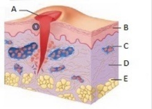   -This is a figure of a skin wound. What does  A  represent? A)  Dermis B)  Subcutaneous adipose tissue C)  Epidermis D)  Blood vessel E)  Blood clot