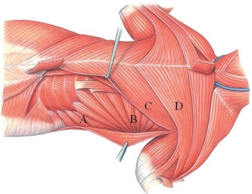 Identify the serratus ventralis in the following image.   A)  A B)  B C)  C D)  D