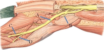 Identify the common fibular nerve in the following figure.   A)  A B)  B C)  C D)  D
