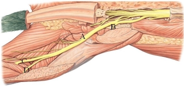 Identify the sciatic nerve in the following figure.   A)  A B)  B C)  C D)  D