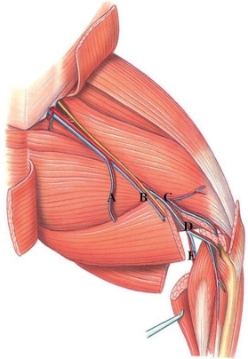 Identify the deep popliteal artery in the figure.   A)  A B)  B C)  C D)  D E)  E