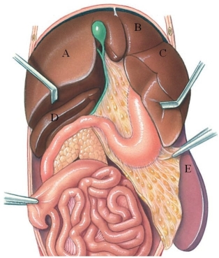 Identify the left medial lobe of the liver in the following figure.   A)  A B)  B C)  C D)  D E)  E