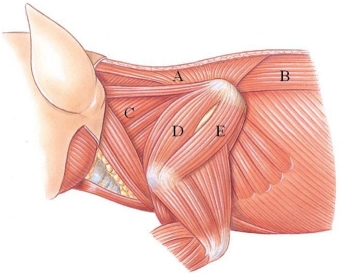 Identify the splenius in the following figure.   A)  A B)  B C)  C D)  D E)  E