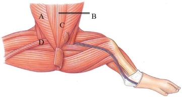 Identify the linea alba in the following figure.   A)  A B)  B C)  C D)  D
