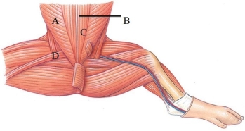 Identify the rectus abdominis in the following figure.   A)  A B)  B C)  C D)  D