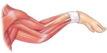 Identify the extensor carpi radialis in the following figure.   A)  A B)  B C)  C D)  D E)  E