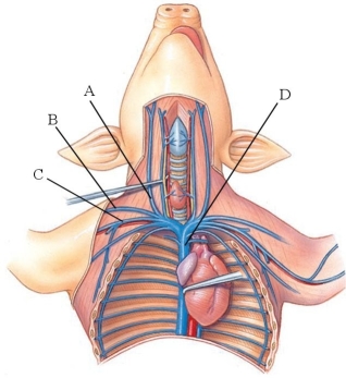 Identify the right cephalic vein in the following figure.   A)  A B)  B C)  C D)  D