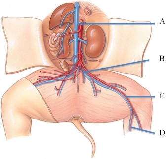 Identify the external iliac vein in the following figure.   A)  A B)  B C)  C D)  D